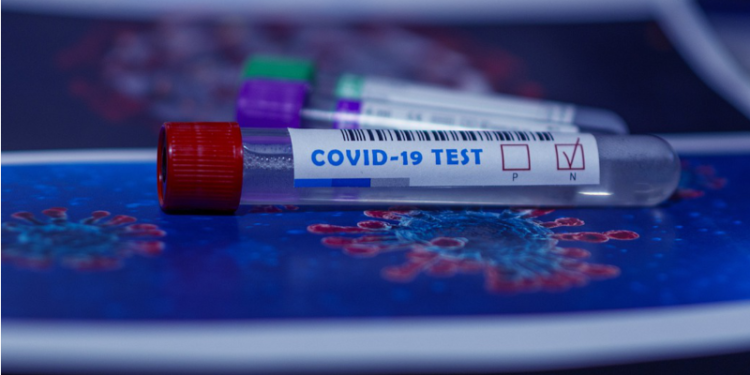 ST. KITTS AND NEVIS LABORATORY WORKING TO MEET INCREASED DEMAND FOR PROCESSING OF COVID-19 TESTS