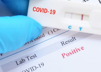 FEDERATION RECORDS ADDITIONAL CASE OF COVID-19 BRINGING TOTAL TO 44 WITH 42 FULLY RECOVERED AND NO DEATHS