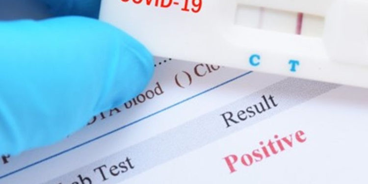 FEDERATION RECORDS ADDITIONAL CASE OF COVID-19 BRINGING TOTAL TO 44 WITH 42 FULLY RECOVERED AND NO DEATHS