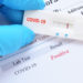 FEDERATION RECORDS ADDITIONAL CASE OF COVID-19 BRINGING TOTAL TO 44 WITH 42 FULLY RECOVERED AND NO DEATHS