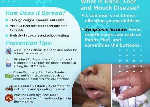 Outbreak of Hand, Foot, and Mouth Disease
